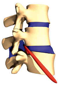 subluxation gif